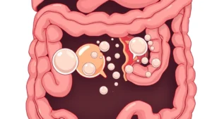 Close-up of digestive system illustration showing gas bubbles in intestines breaking apart, medical diagram style, educational visualization, no text labels